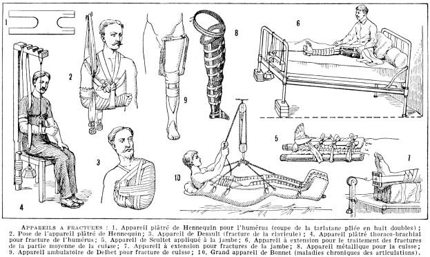 Eine Schwarz-Weiß-Zeichnung eines Mannes im Krankenhausbett mit einem Gips am Bein, umgeben von Fotos von Menschen, einer Person auf einem Stuhl und verschiedenen Gegenständen, mit der Beschriftung "Arm- und Beinfrakturen" unten.